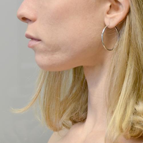 XENOX Orecchini A Cerchio Dome Medium - Donna In Argento Sterling 925. Gioielli Di Alta Qualità, Design Elegante E Semplice Per Ogni Occasione. Ideali Come Regalo Per La Festa Della Mamma O Compleanno.
