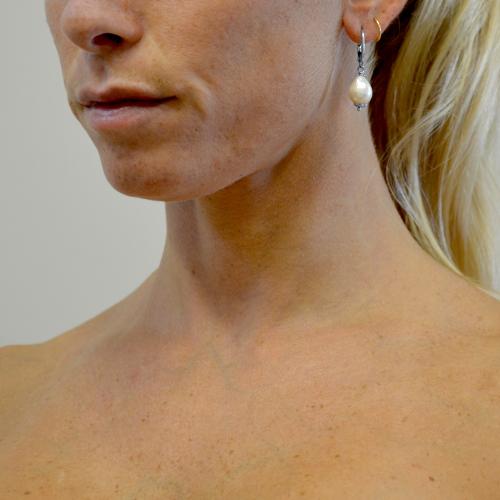 Orecchini Con Perle Barocche Bianche Grandi, Quasi Rotonde, Da 12 Mm, Orecchini Con Perle Ondulate, Orecchini Con Perle Simili A Quelle Di Kasumi, Orecchini Con Perle D'acqua Dolce Edison - Italia