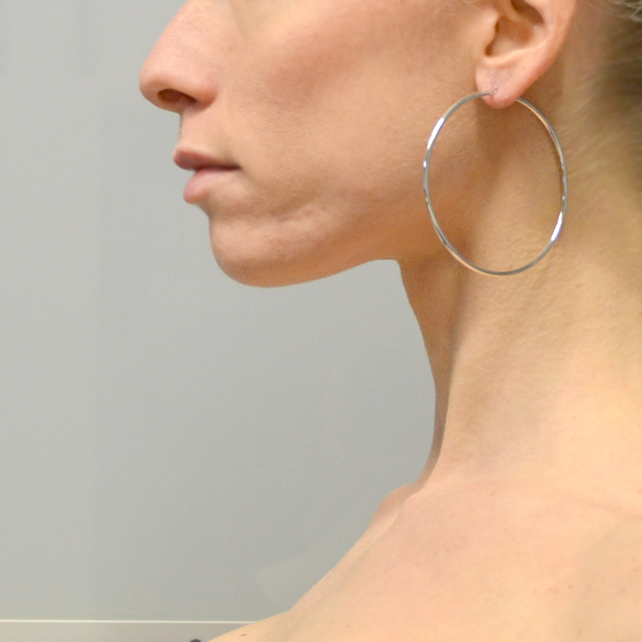 Orecchini A Cerchio Classici In Argento 925 Con Opale E Zircone Rotondo~p136984059 - Foto 4